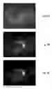 Fig. 09 - Retinal image processing