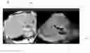 Fig. 01 - Ultrasound imaging system and method for image guidance procedure