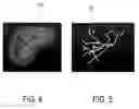 Fig. 05 - Ultrasound imaging system and method for image guidance procedure