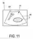Fig. 11 - Ultrasound imaging system and method for image guidance procedure