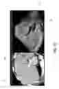 Fig. 12 - Ultrasound imaging system and method for image guidance procedure