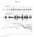 Fig. 04 - Method and apparatus for processing audio signal including shock noise