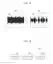 Fig. 09 - Method and apparatus for processing audio signal including shock noise