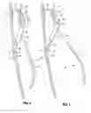 Fig. 05 - Adjustable back support assembly for the back of a chair