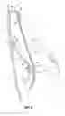 Fig. 06 - Adjustable back support assembly for the back of a chair