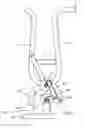 Fig. 08 - Hand operated fruit squeezer