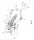 Fig. 04 - Endoscope with guide