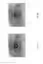 Fig. 04 - Systems, methods, and devices for detection and diagnosis of brain trauma, mental impairment, or physical disability