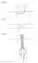 Fig. 03 - Body Lumen Occlusion Apparatus and Methods
