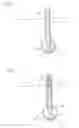 Fig. 04 - Body Lumen Occlusion Apparatus and Methods