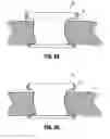 Fig. 06 - Attachments for use with a surgical access device
