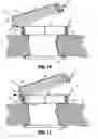 Fig. 08 - Attachments for use with a surgical access device