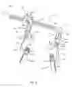 Fig. 04 - Spinal correction system and method