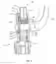 Fig. 06 - Spinal correction system and method