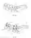 Fig. 13 - Spinal correction system and method