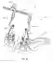 Fig. 17 - Spinal correction system and method