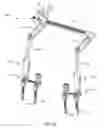 Fig. 28 - Spinal correction system and method