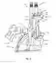 Fig. 09 - SPINAL CORRECTION SYSTEM AND METHOD