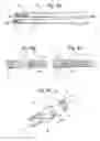 Fig. 07 - Bone anchoring system, associated implant and instrumentation