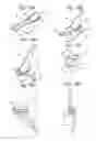 Fig. 16 - Bone anchoring system, associated implant and instrumentation