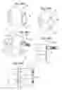 Fig. 30 - Bone anchoring system, associated implant and instrumentation