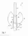 Fig. 02 - Tooth replacement forming device, and method for forming a tooth replacement