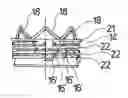 Fig. 01 - Heart valve prosthesis