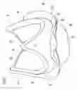 Fig. 02 - Heart valve prosthesis