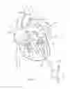 Fig. 02 - Expandable epicardial pads and devices and methods for delivery of same