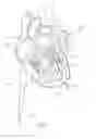 Fig. 06 - Expandable epicardial pads and devices and methods for delivery of same
