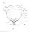 Fig. 08 - Expandable epicardial pads and devices and methods for delivery of same