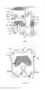 Fig. 03 - Resilient interpositional arthroplasty device