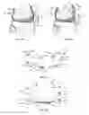 Fig. 08 - Resilient interpositional arthroplasty device