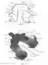 Fig. 12 - Resilient interpositional arthroplasty device