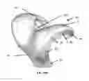 Fig. 15 - Resilient interpositional arthroplasty device