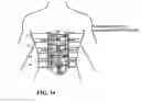 Fig. 19 - Adaptive compression therapy systems and methods