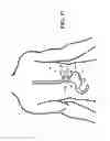 Fig. 32 - Adaptive compression therapy systems and methods