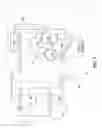 Fig. 04 - Ambulatory lung assist device with implanted blood pump and oxygenator