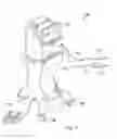 Fig. 02 - Intraocular pressure sensing systems, devices, and methods