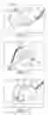 Fig. 02 - DELIVERY OF RESPIRATORY THERAPY