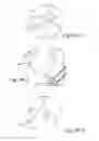 Fig. 45 - DELIVERY OF RESPIRATORY THERAPY