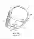 Fig. 76 - DELIVERY OF RESPIRATORY THERAPY