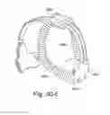 Fig. 85 - DELIVERY OF RESPIRATORY THERAPY