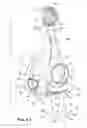 Fig. 08 - Mask assembly with cushion-receiving channel and partial bead therein