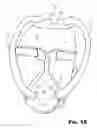 Fig. 08 - CONTINUOUS POSITIVE AIR PRESSURE MASK SYSTEM
