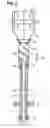 Fig. 03 - Catheter device having a catheter and an actuation device