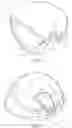 Fig. 02 - Golf club having removable weight