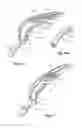 Fig. 06 - Hand implement with shock absorber