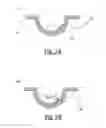 Fig. 04 - Method of manufacturing hydrogel ophthalmic devices with electronic elements