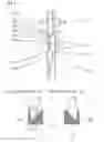 Fig. 05 - Pneumatic Vehicle Tyre